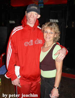 Yellowman